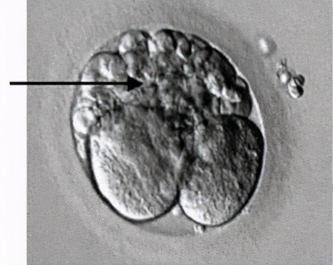 低评分胚胎，生出的宝宝不健康？