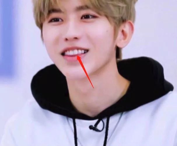 矫正后两年反弹会越来越严重吗,矫正完成两年牙齿还是松动