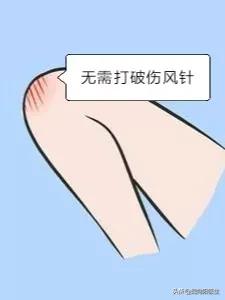 打破伤风抗毒素过敏怎么办,猪用破伤风抗毒素过敏咋治