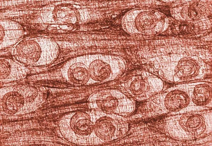 吃虫子减肥,减肥吃虫子的方法