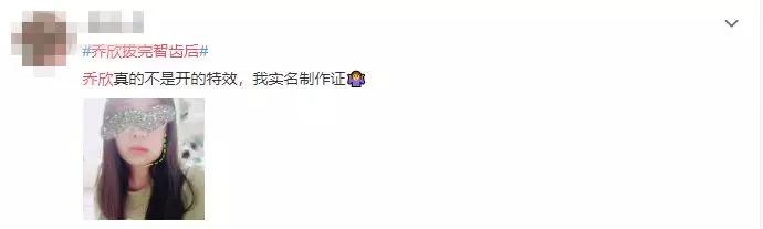 明星拔了智齿有垮脸的吗,明星拔完智齿