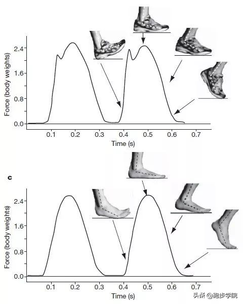 伤害了1/3跑者的胫骨炎,请务必重视起来