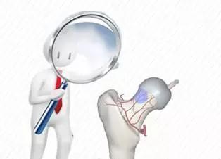 股骨头坏死下肢酸疼,股骨头坏死患者会膝关节疼痛