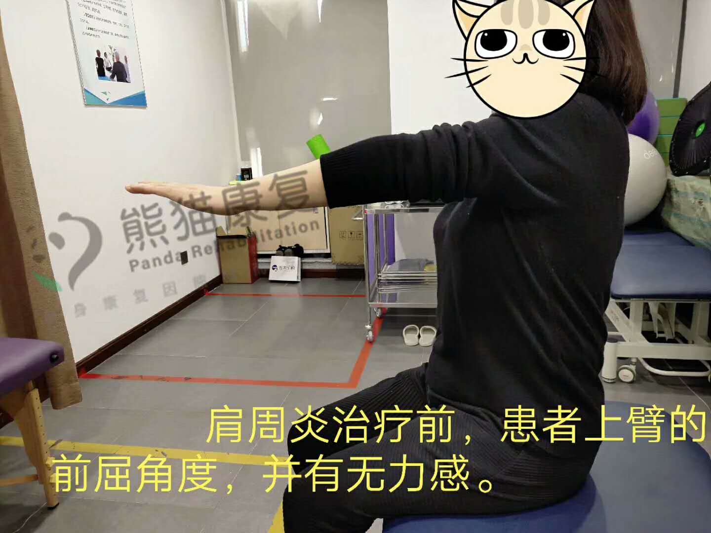 肩颈理疗瑜伽一招解决肩膀疼痛,肩膀咔咔卡住一招恢复好