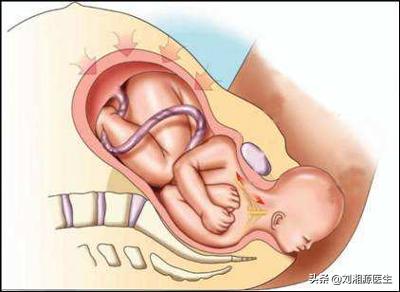 系统性血管炎怀孕能要吗,怀孕得了血管炎怎么办