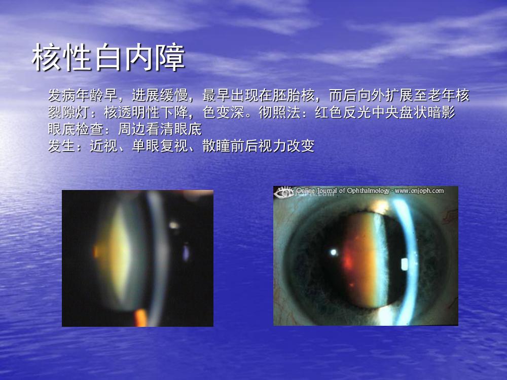 肾病综合征抽血生化报告单怎么看,肾病综合征检查血液哪些指标