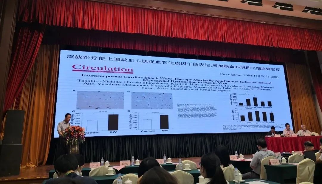 上海十院徐亚伟教授:体外心脏震波治疗术可促进侧支循环加速建立