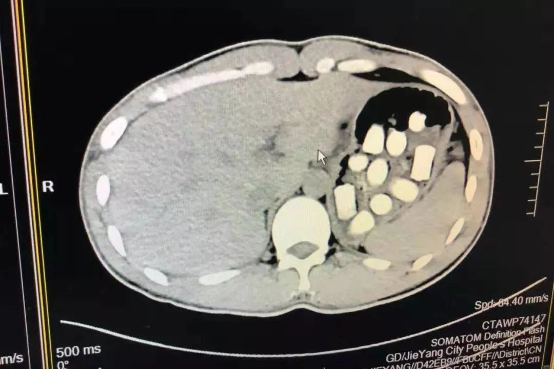 运毒者被抓现场,运毒被抓现场