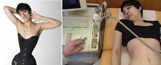 塑身衣真的能瘦腰减肥,塑身衣瘦腰减肚子束腰搭扣