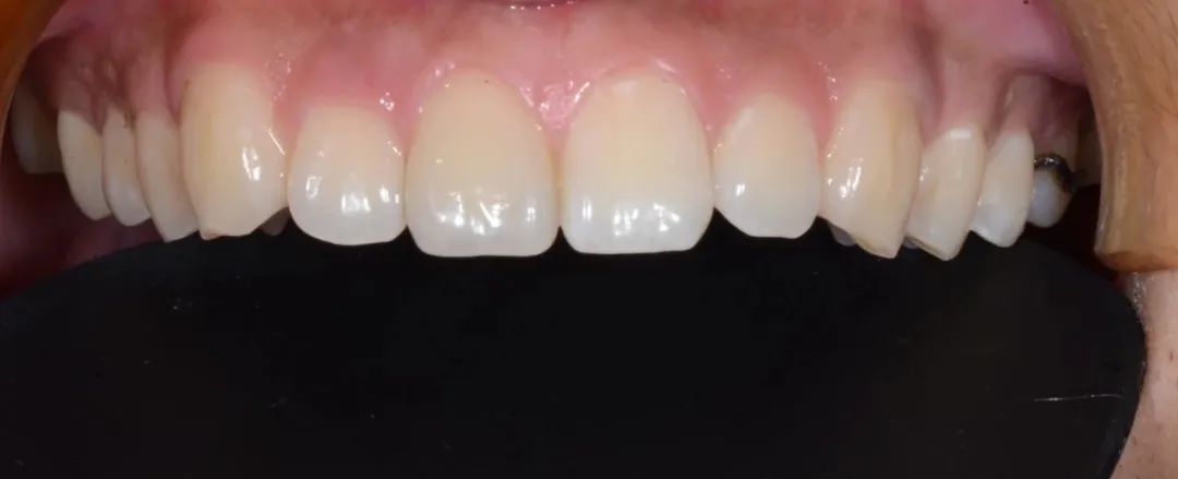 美白牙膏去牙黄真实有效测评,美白牙膏真实测评护牙效果