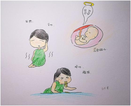 二胎妈妈发烧死亡,二胎妈妈怀孕一个月患重症