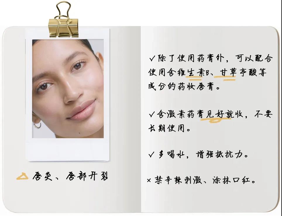 有什么好用的润唇膏适合推荐,哪些超好用的润唇膏比较好用