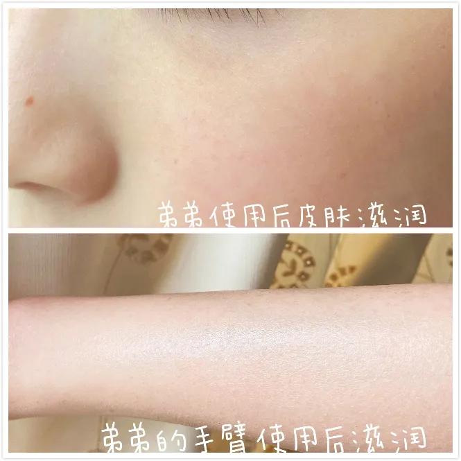 日本抗痘护肤品牌,日本护肤品淡斑美白排行榜