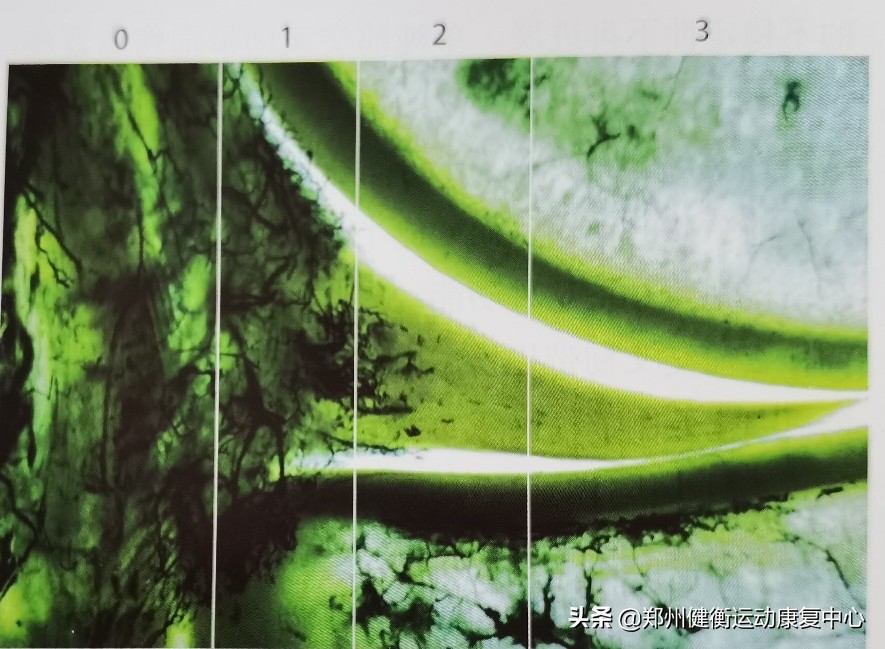 干货来了翡翠知识全解,半月板科普15秒视频