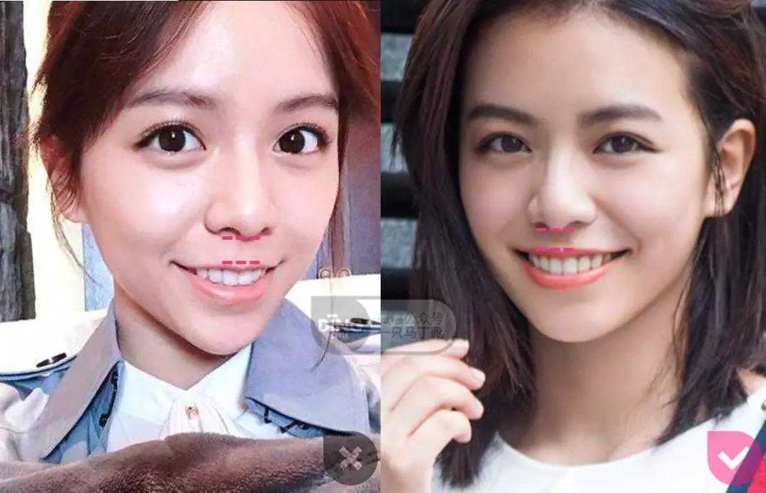 凸嘴微笑练习方法表情管理,前凸嘴怎么做表情管理