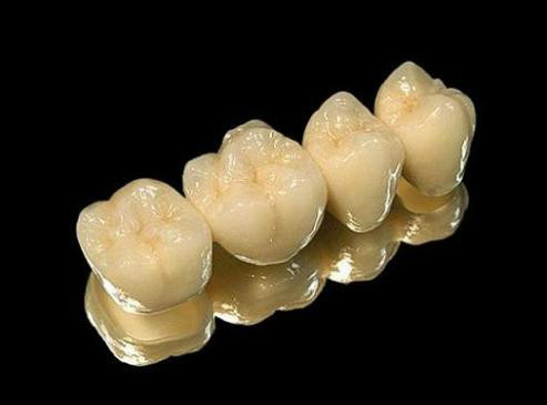 假牙的种类及价格详细介绍图片,目前国内最好的假牙是多少钱