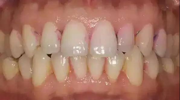 月子牙刷好用吗,月子牙刷好用么