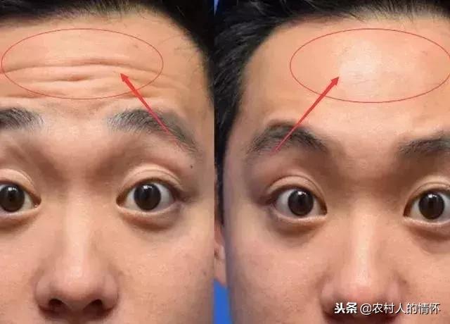 看额头三才纹知命运图解,男人额头有纹和地纹代表什么意思