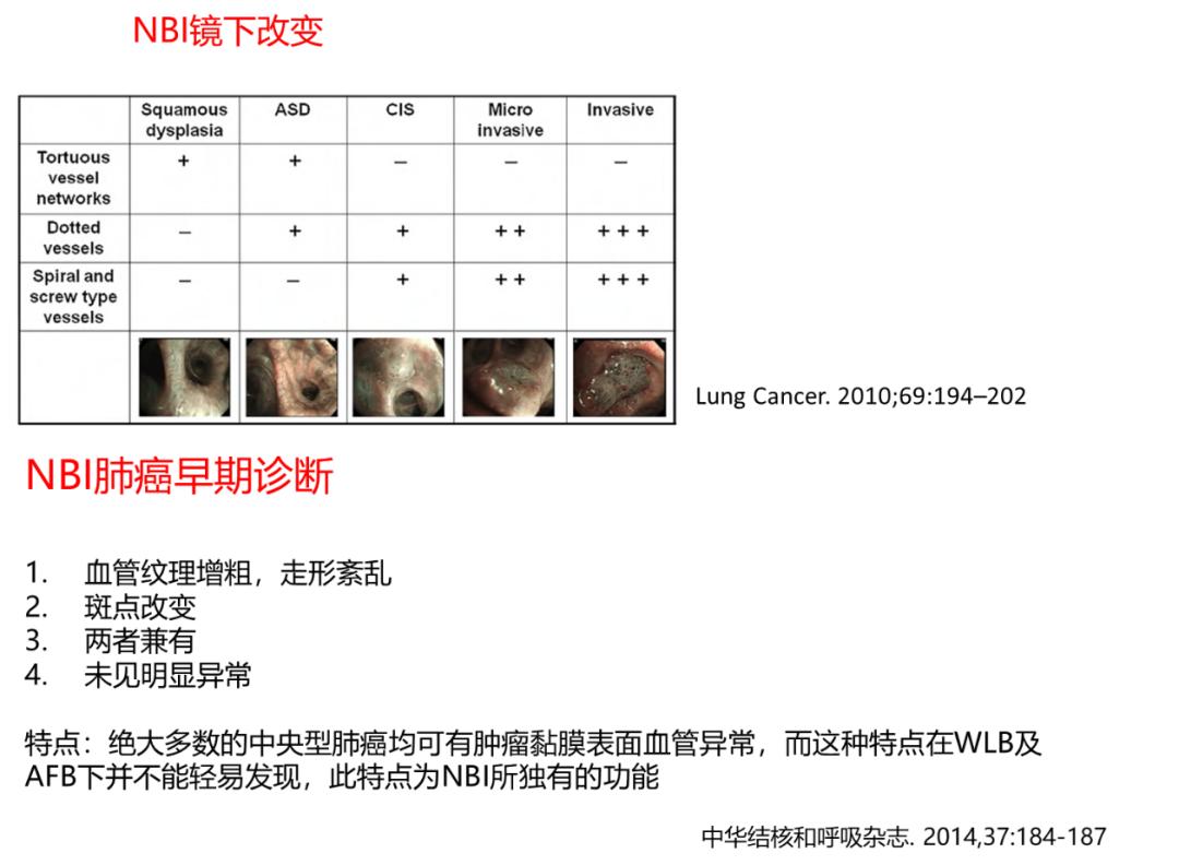 支气管镜高频电刀治疗中央型肺癌,支气管镜在早期肺癌诊断的意义
