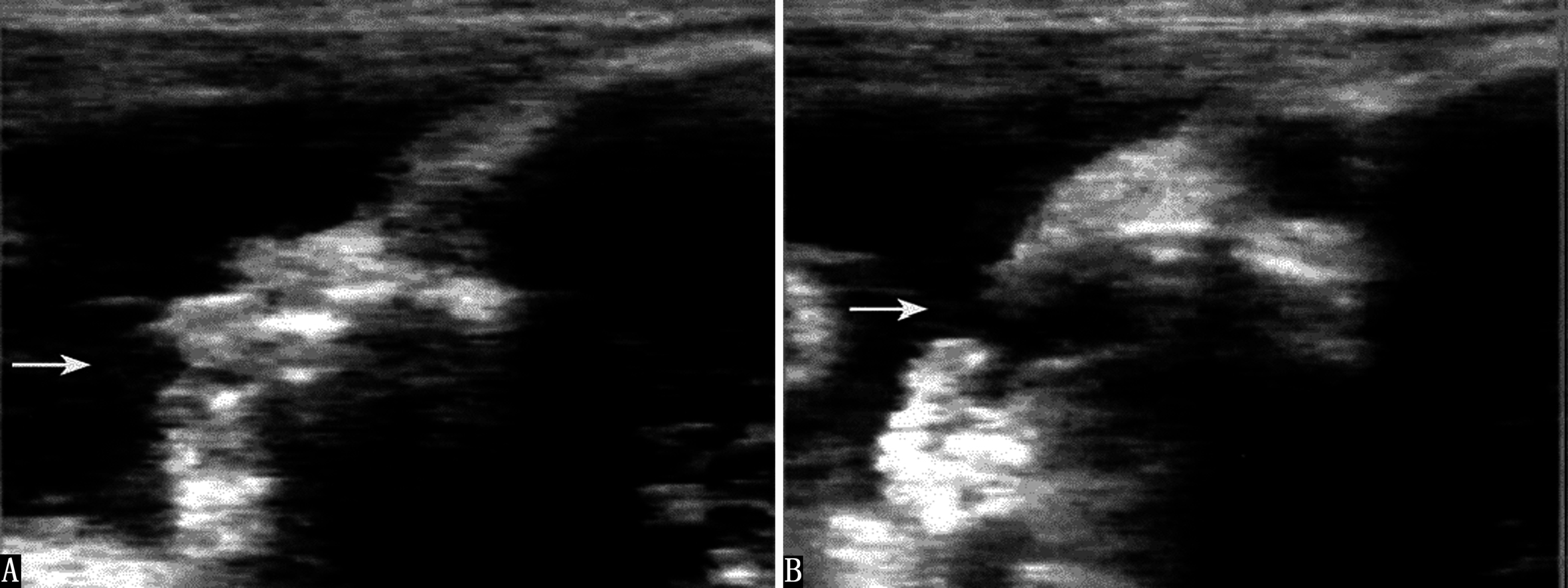 做胎儿心动图胎心165次每分,做彩超胎儿动来动去
