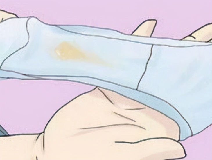 女人妇科瘙痒白带发黄,白带异常瘙痒有臭味