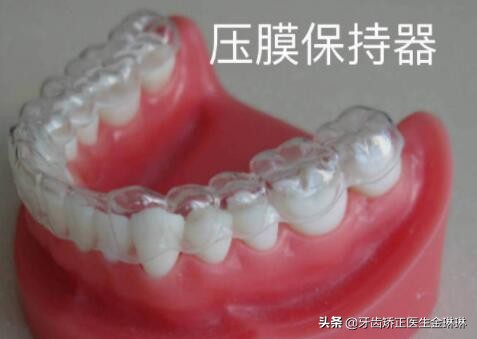 透明保持器和钢丝保持器,钢丝保持器和透明保持器哪个贵