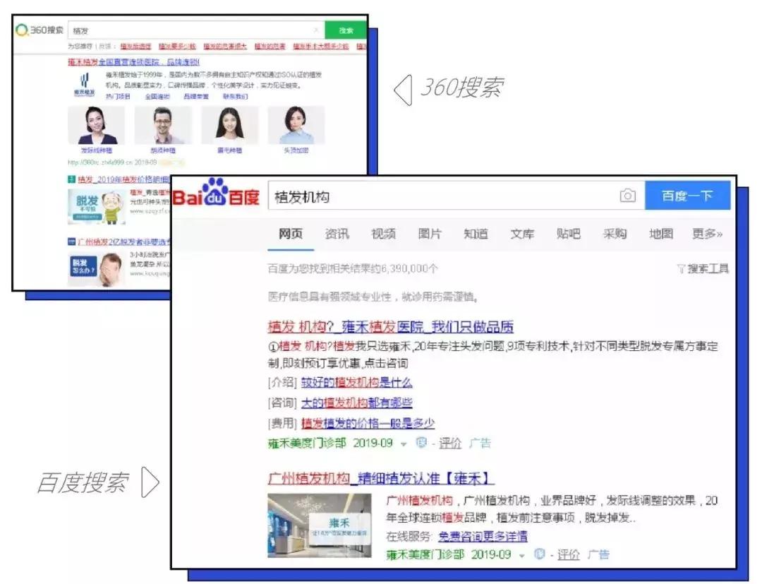 90后秃头开始被资本收割了,90后秃然崛起你们的发际线还好吗