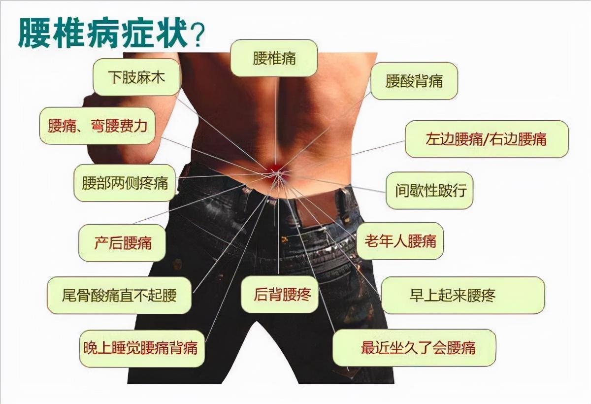 腰椎间盘突出症保守疗法的机理,西医治腰椎间盘突出的保守治疗