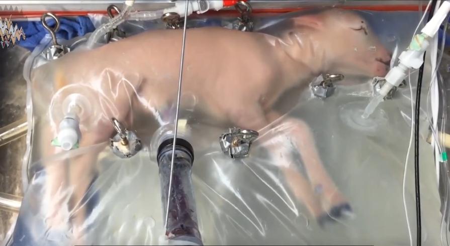 人造子宫实现让人类复活,人类能接受人造子宫吗