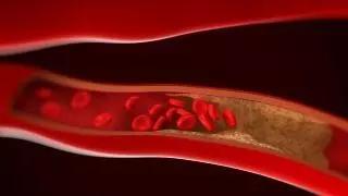 吃了他汀伤肝怎么补救,他汀的副作用与危害伤肝吗