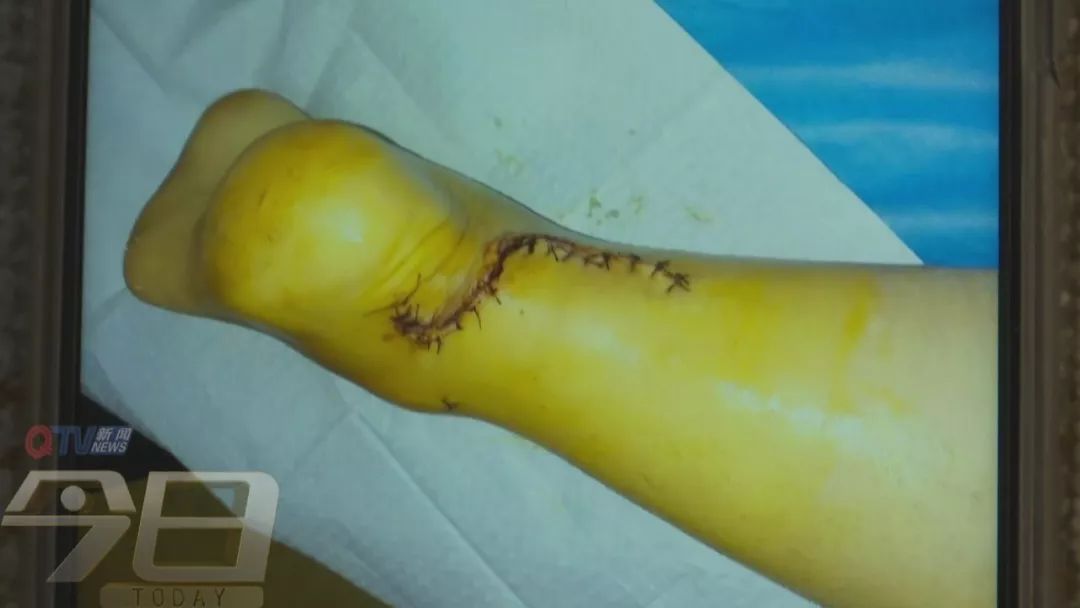 娲椾釜婢℃妸鎵嬫憯鏂簡8鏍圭瓔,娲椾釜婢℃憯浜嗕竴璺ら鎶樹簡