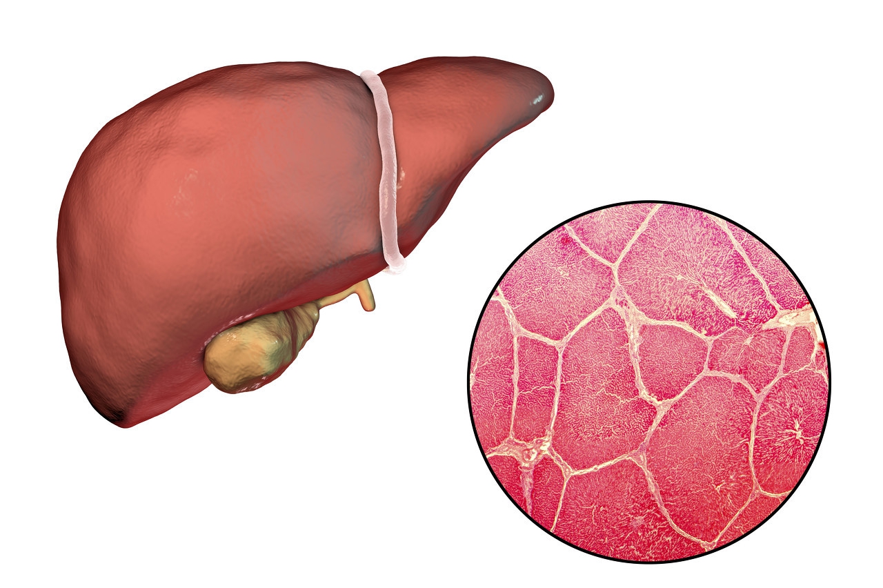 人肝不好怎么保养,人肝不好怎么锻炼