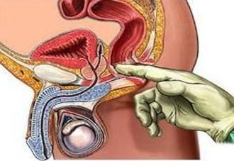 肛诊的具体操作步骤,肛肠病诊疗