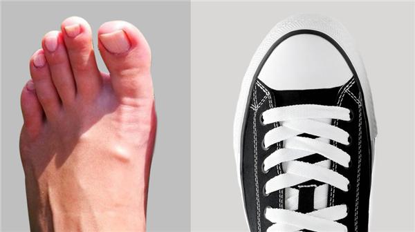 如何科学选鞋的五种方法,骨科医生教你五个挑好鞋的技巧