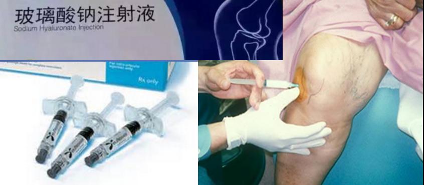 膝关节骨性关节炎症状及治疗,膝关节骨性关节炎诊疗指南下载