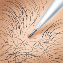 刘海可以盖住发际线的发型,适合发际线高并且没有刘海的发型