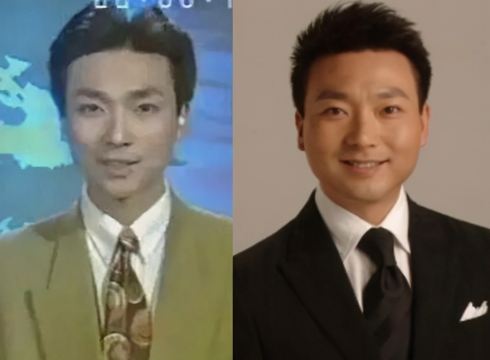 如何改善咬肌鹅蛋脸,咬肌变大脸发腮怎么改善