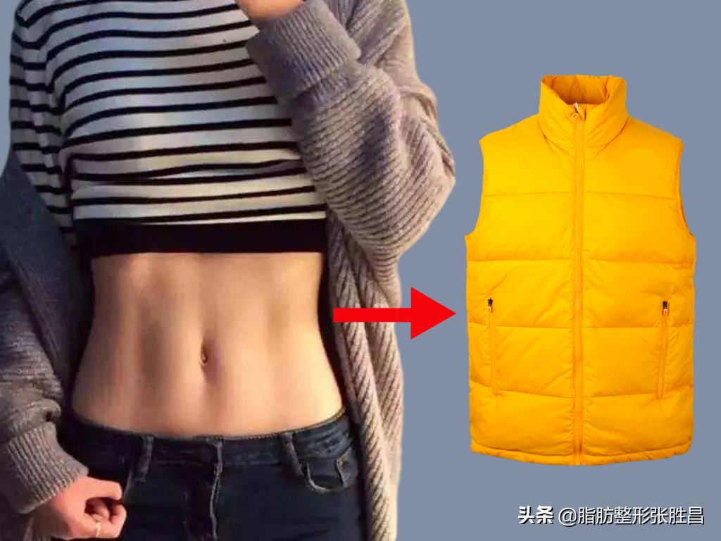 马甲线和腰腹吸脂有什么区别,想要马甲线不想运动