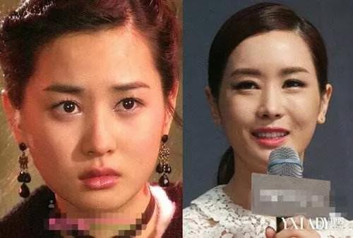 整容自毁前程的女明星,整容失去灵魂的女明星