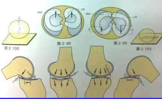 半月板损伤的症状及治疗方法,半月板损伤自测