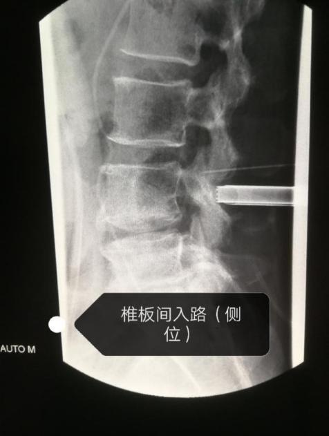 那天，市第二人民医院收到一件特殊的包裹……