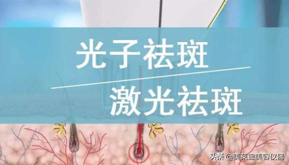 美容仪器和激光祛斑,美容仪器祛斑有效果吗