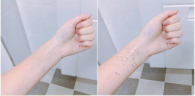 洗澡搓泥后起疙瘩,洗澡时搓出来的泥是怎么回事