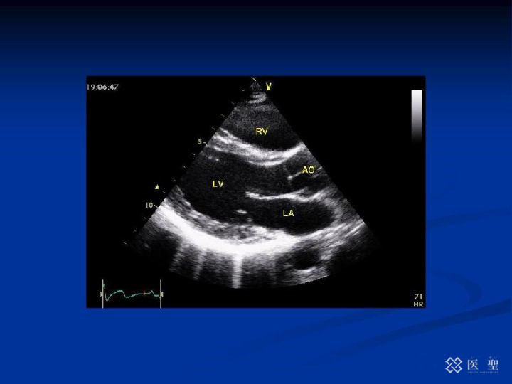 iseihealth:医生提醒即使没有疼痛或不适，也不要忽视血尿