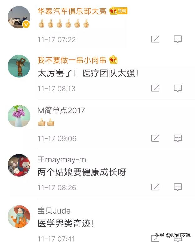 坐骨连体双胞胎多大分离,中国首例坐骨婴儿手术成功完整版