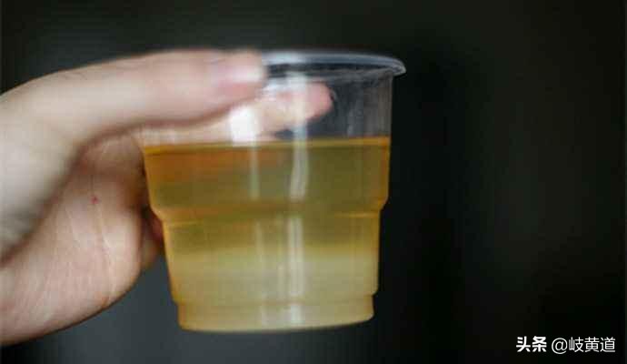 尿路感染引起的尿频尿急的症状,最近尿路感染尿频尿急怎么办