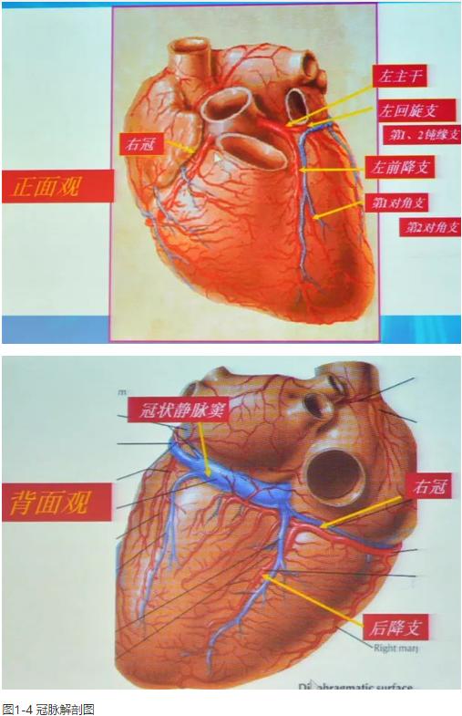 清晰完整揭秘冠脉造影全部过程,冠脉造影教学视频
