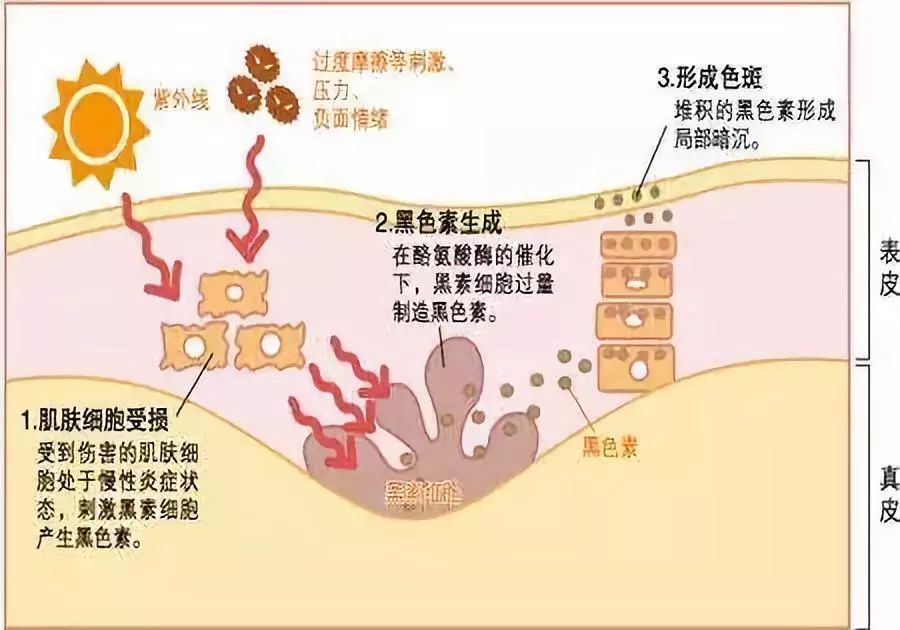 theordinary烟酰胺精华怎么样,ordinary烟酰胺精华真假
