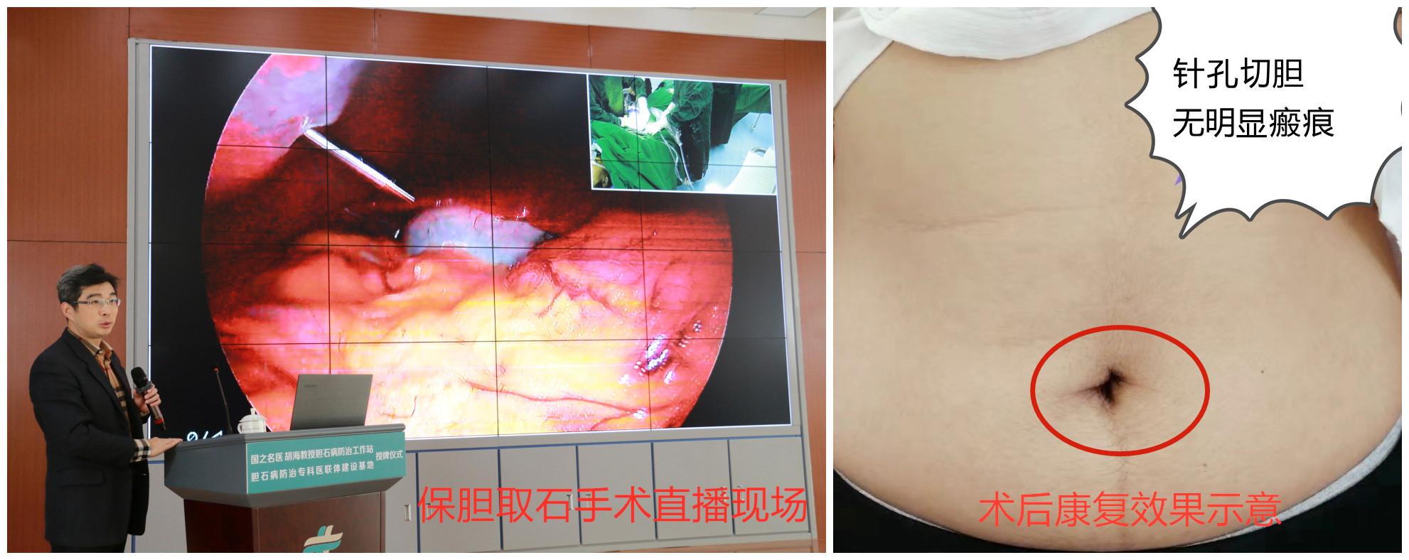 中国结石病防治中心官网,中国结石病防治中心图