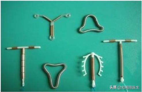 免疫治疗不良妊娠的方法,宫腔粘连合并妊娠